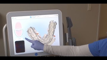 iTero Element 5D Imaging System