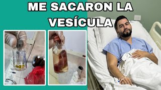 Me Operaron De La Vesícula Tenia Piedras En La Vesícula Storytime Dr David Campos