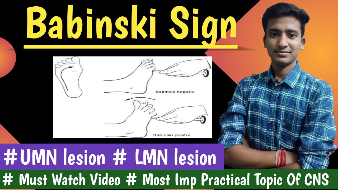Babinski signUpper and Lower motor neuron lesion CNS Physiology