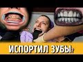 Вся ПРАВДА про ОТБЕЛИВАНИЕ ЗУБОВ. Моя реальная история у стоматолога.