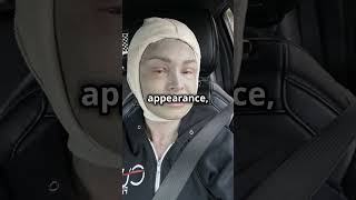 Tamra Judge's Shocking Transformation After Extreme Cosmetic Procedure!