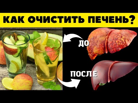 Как ОЧИСТИТЬ ПЕЧЕНЬ за 2 недели в домашних условиях...