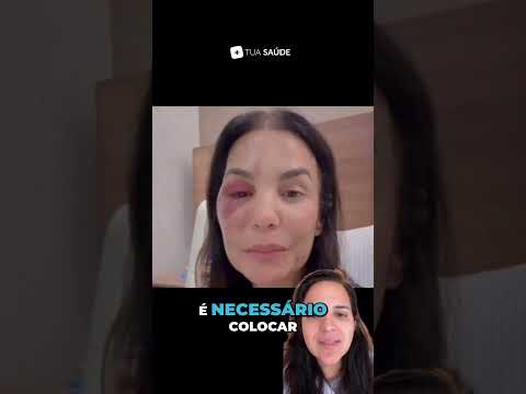 Síndrome Vaso Vagal: Ivete Sangalo e o que você precisa saber