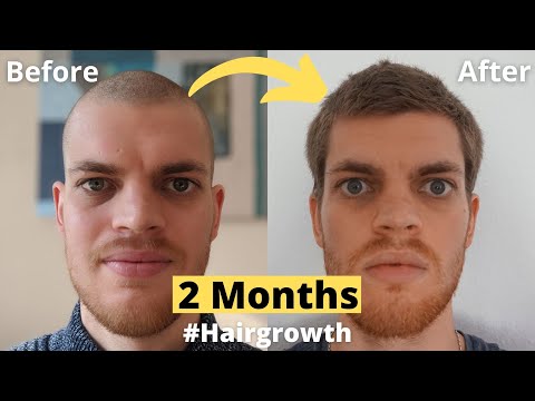 Hair Growth Time Lapse 2 Months - From Buzz Cut