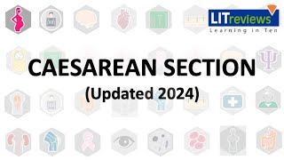 (New) Caesarean Section