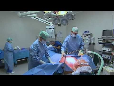 Video: Mannelijke Schoonheid: Beroemde Mannen Die Plastische Chirurgie Hebben Ondergaan