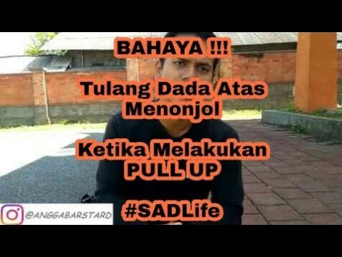 Video Nyeri Tulang Dada Atas