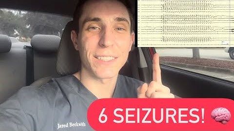 I detected 6 seizures on long-term EEG monitoring!
