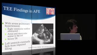 Amniotic Fluid Embolism: Latest Update