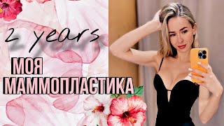 ПЛАСТИЧЕСКИЙ ДНЕВНИК #6 ДВА ГОДА после маммопластики | Занятия спортом