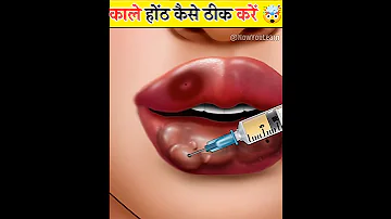 Dark Lips कैसे ठीक करें 🤯। #shorts #animation #viral #trending #asmr