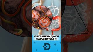 Organizmdagi Parazitlar Gijjalar #doctoruz #shortvideo #doctor #организм #gijja #short