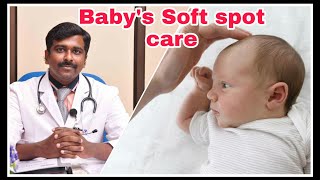 Know about your baby's soft spot | Problems of baby's soft spot | English | Dr Sudhakar screenshot 5