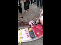 Woman give birth on street