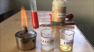 Urine Analysis for Abnormal Constituent | Sugar Test by Benedict's Reagent in Urine | यूरिन सुगर