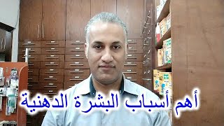 البشرة الدهنية وأهم أسباب ظهورها