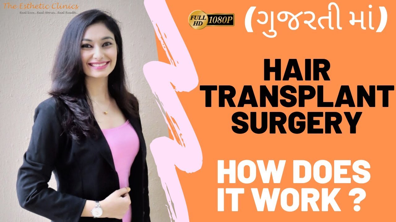 (In Gujarati) Hair Transplant Surgery in Ahmedabad, Gujarat [How Does