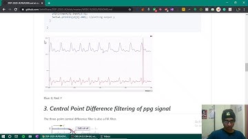 17EC01043 Lab 2 | Filters with ppg