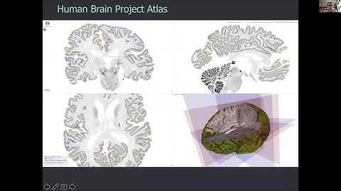 Konrad Wagstyl - BigBrain atlas of cortical layers