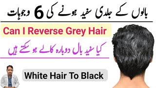 What causes white hair at a young age Urdu Hindi | Safed balo ko kala kaise karen | Irfan Azeem |