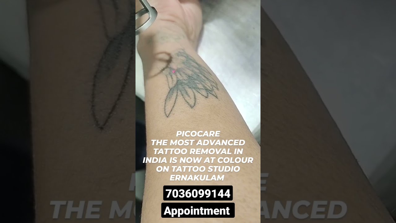 The Tattoo Removal Clinic in Banjara HillsHyderabad  Best Clinics in  Hyderabad  Justdial