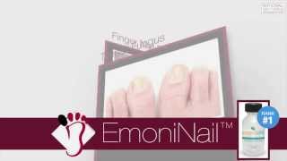 EmoniNail Toenail Fungus Treatment - Video Review