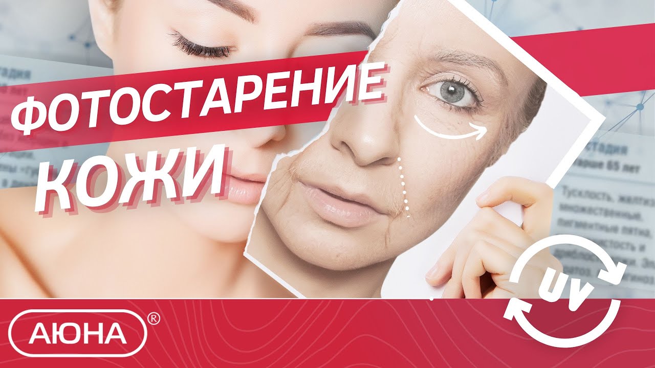 Фотостарение | Подробный разбор шкалы фотостарения по Р. Г. Глогау