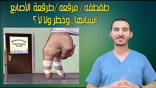 طقطقه / فرقعه /طرقعة الأصابع. أسبابها ، وخطر ولا لأ ؟