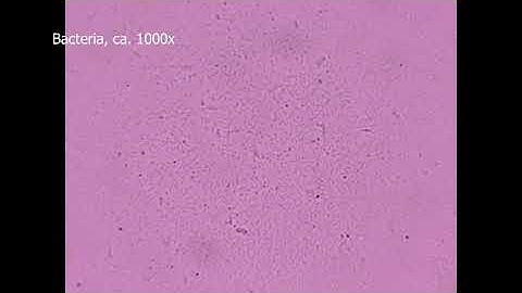 16/11/2025 Bacteria and Ciliates