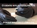 Sulcos e Lóbulos de Desenvolvimento | Anatomia Dental