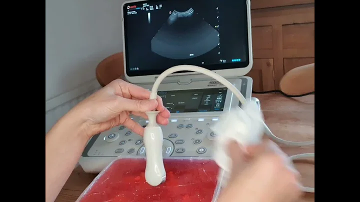 Ultrasound-guided aspiration