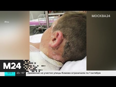 Генконсульство РФ рассказало о состоянии пострадавших в Турции детей - Москва 24 происшествия брест
