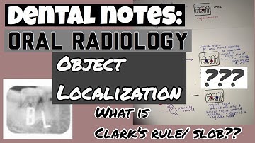 OBJECT LOCALIZATION || CLARKS OR SLOB TECHNIQUE || ORAL RADIOLOGY || DENTAL NOTES (simplified)