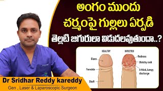 అంగంపై ఇలా ఉందా || Best Treatment For Balanitis in Telugu || Diabetes || Treatment Range Hospital