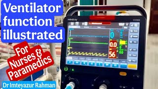 Ventilator function (life support system)illustrated,वेंटीलेटर कैसे काम करता है ।