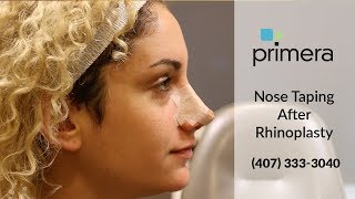 How To Tape Your Nose After Rhinoplasty (Nose Job) | Orlando Plastic Surgeon Dr. Edward J. Gross