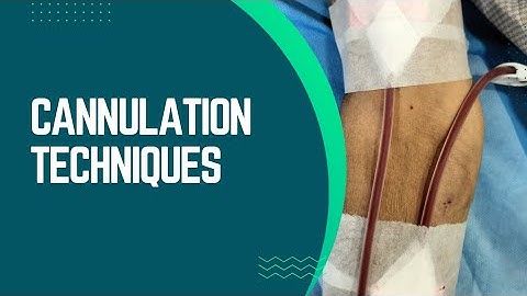 Tips And Tricks Of Cannulation Techniques | AVF cannulation in #dialysis #dcdc #ttt #nabh #kidney