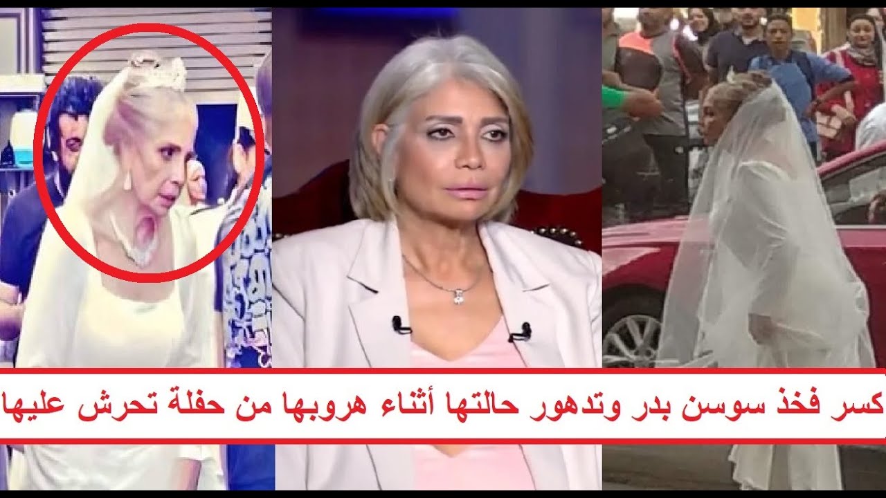 مفاجأة وراء كسر فخذ الفنانة سوسن بدر «اتكسرت وهي بتهرب في وسط البلد»