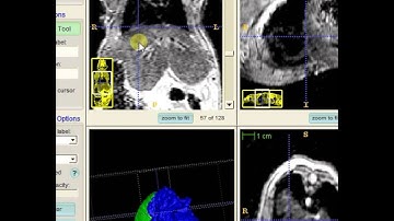 Mouse Liver segmentation with ITK-Snap v2.4