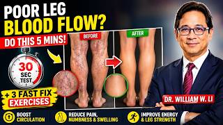 Poor Leg Circulation? 30-Second Test + 3 Fast Fix Exercises |DR. William W. li ]
