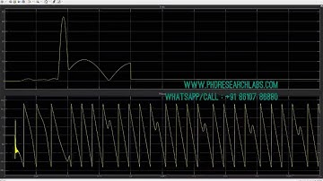 Analysis and Modeling of High Impedance Fault matlab simulink model