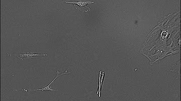 [JuLI Stage Application Video] Stem cell monitoring with time-lapse imaging for 16 hours