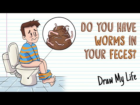 INTESTINAL WORMS IN OUR FECES? | Draw My Life