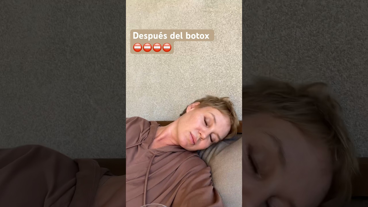 Que no podemos hacer después del tratamiento con botox 