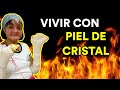 VIVIR CON PIEL DE CRISTAL (Entrevista a Soni)