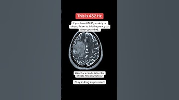 This is 432 Hz. How do you feel?