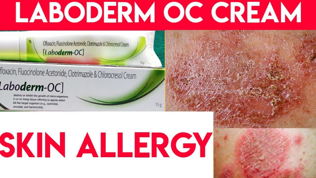 Laboderm oc cream review in hindi fungal infection skin allergy uses ...