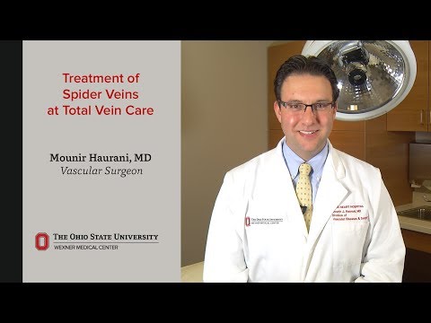 Spider vein treatment