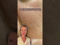 Você já usou algum desses produtos? #skincare #porosdilatados #peleoleosa #dermatologista #viralreel