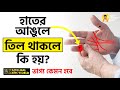 হাতের আঙুলে তিল থাকলে ভাগ্য কেমন হবে  Hater Angule Til Thakle Ki Hoy